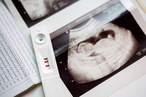 photo of ultrasound